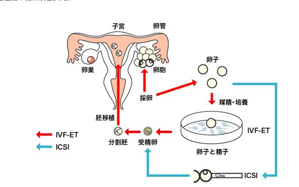 广州试管供卵产子(广州试管供卵产子服务全面介绍)